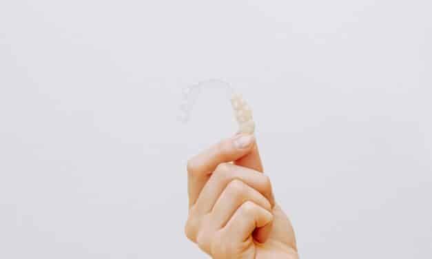 Is Invisalign Right For Me? Everything You Need to Know Before Starting Your Treatment Journey